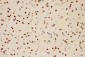 Anti-PIAS1 Antibody